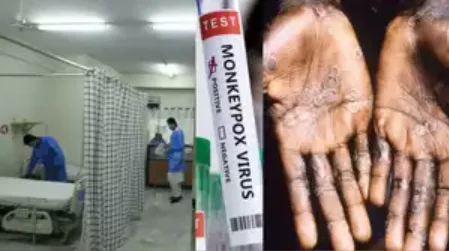 Screenshot 2024-08-24 141210 Thailand Reports First Case of Deadly Mpox Virus Clade Ib in Asia: Understanding the Risks and Transmission